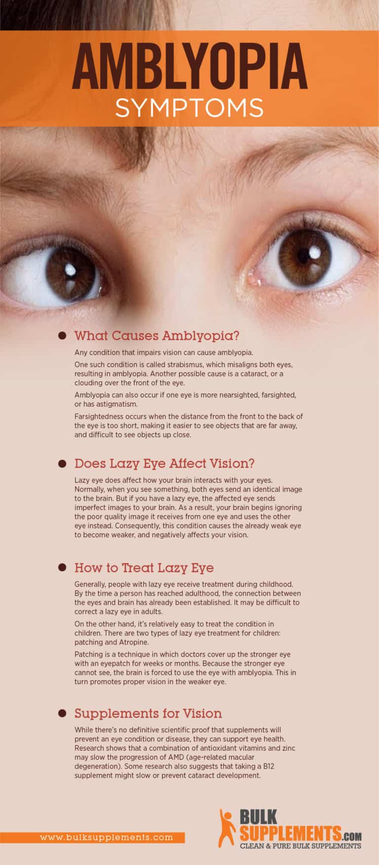 Amblyopia Lazy Eye Symptoms Diagnosis And Treatment