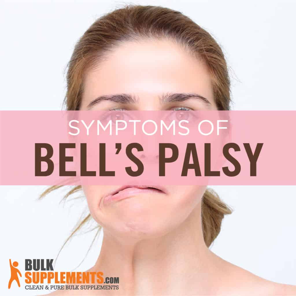 Bell's Palsy Symptoms, Causes & Treatment