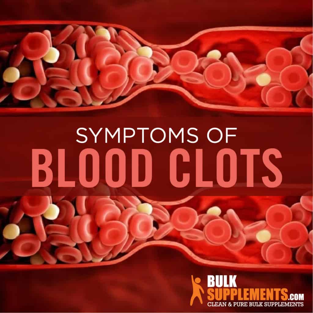 Blood Clots Symptoms, Causes and Treatment