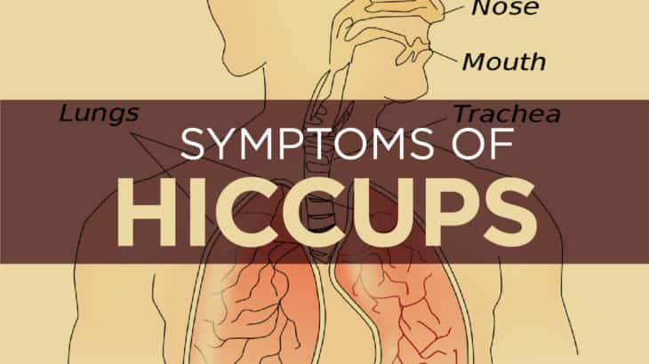 Hiccups