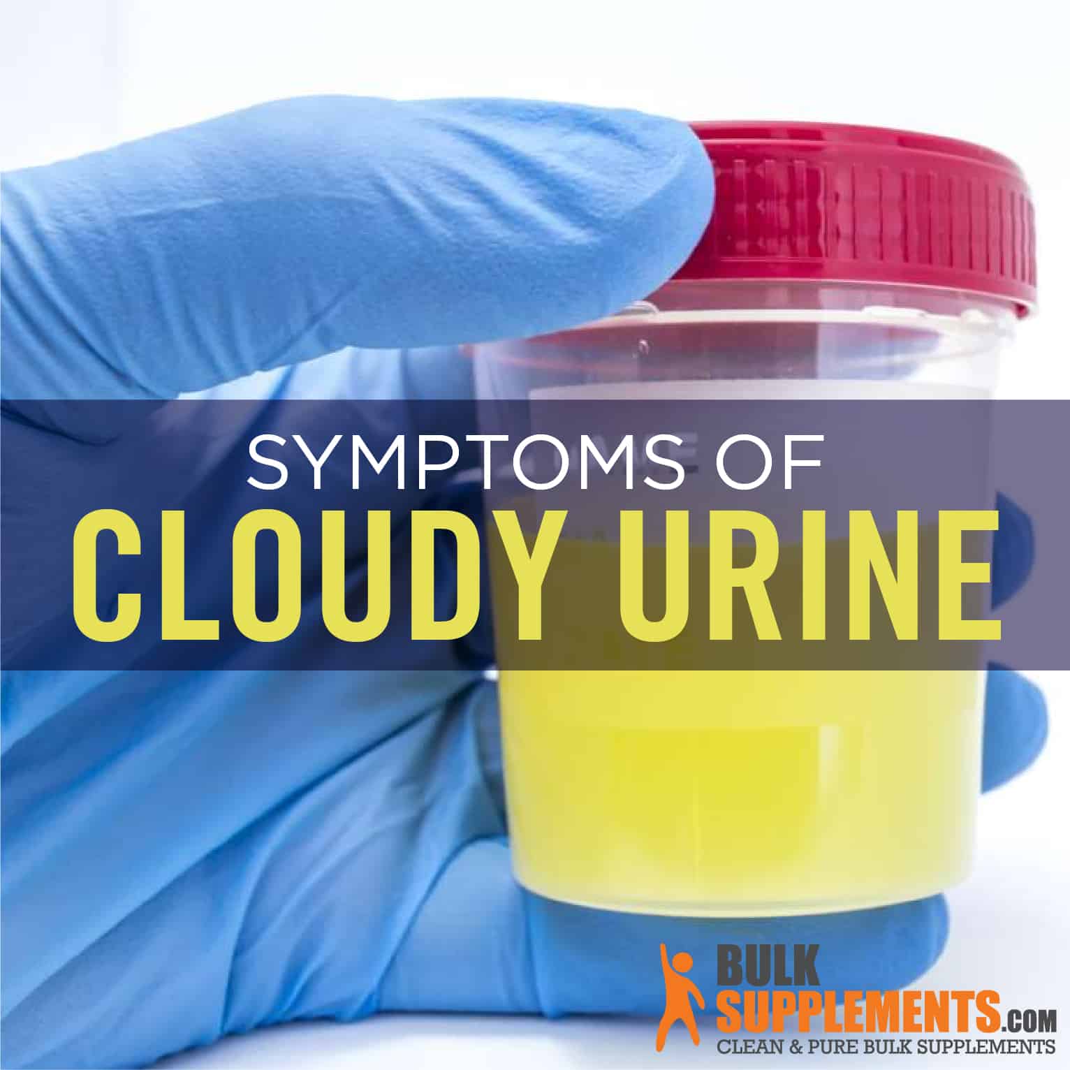 What Cloudy Urine Looks Like