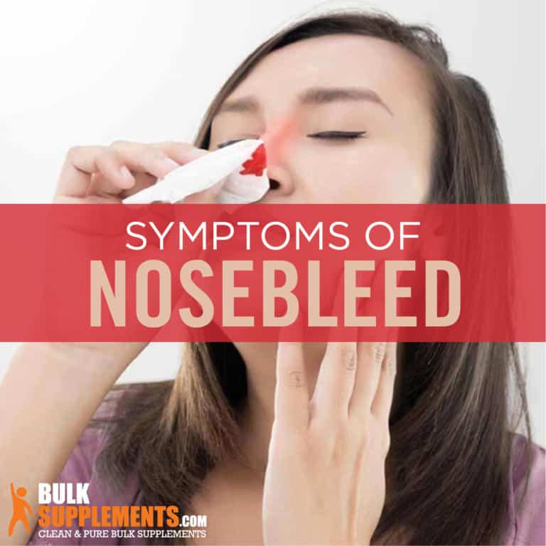 Nosebleed Characteristics, Causes & Treatment