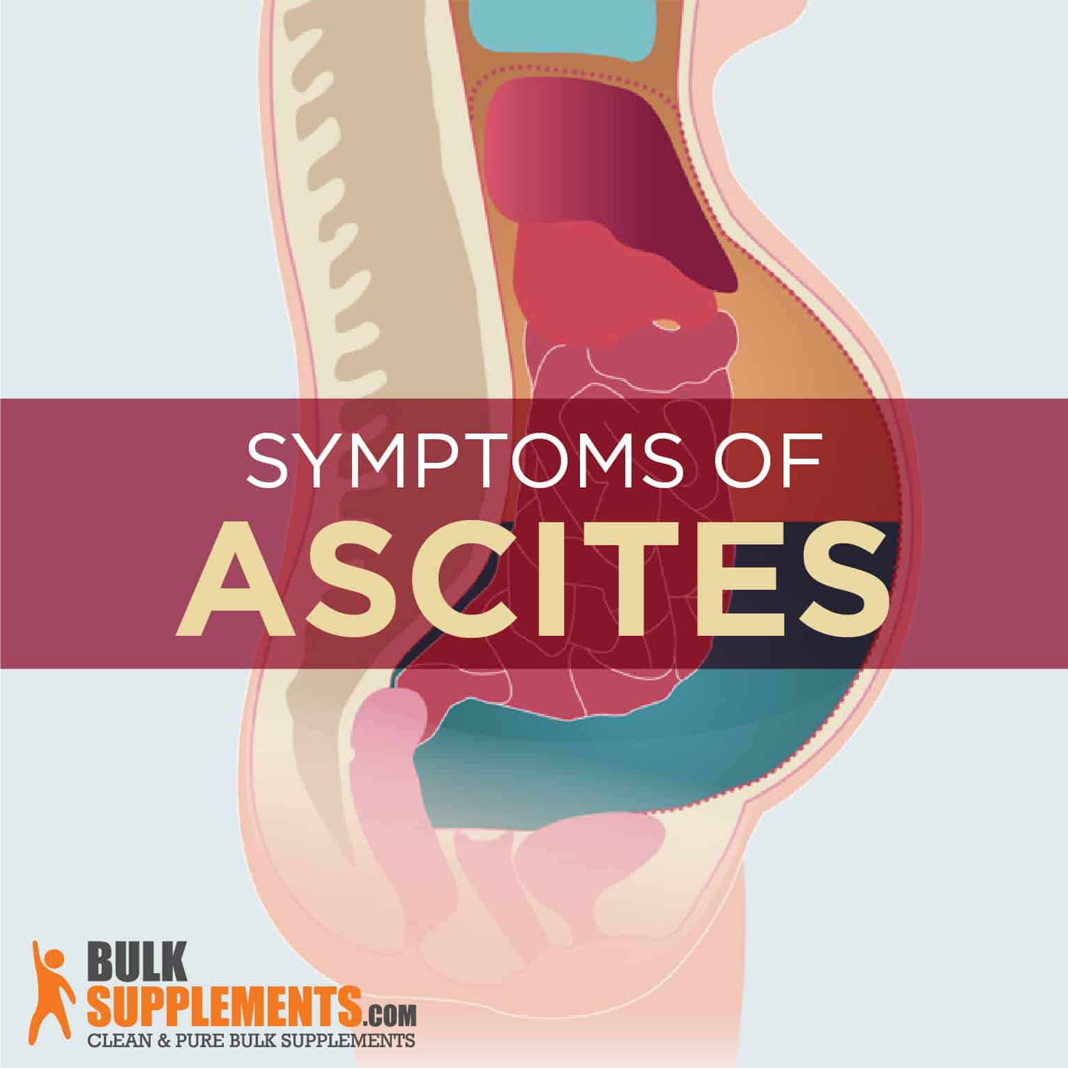 Ascites