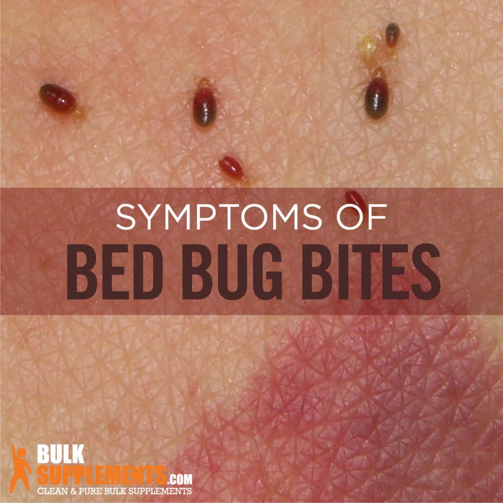 do bed bug bites travel