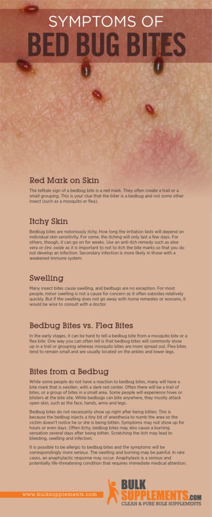 Bed Bug Bites: Characteristics, Causes & Treatment