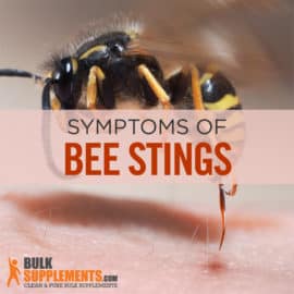 Bee Stings: Characteristics, Causes & Treatment