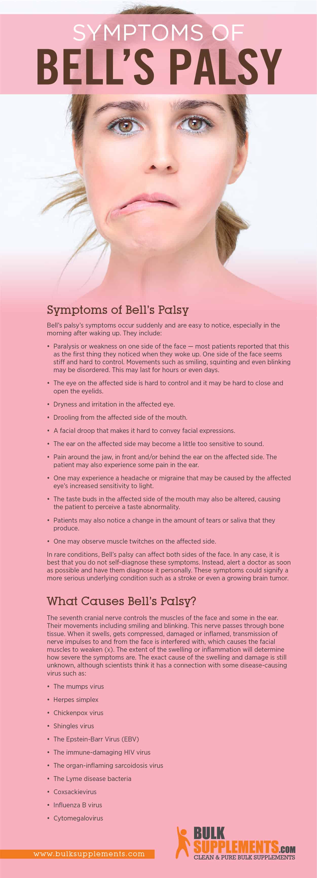 Bell's Palsy Infographic