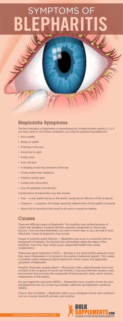 Blepharitis Symptoms, Causes & Treatment