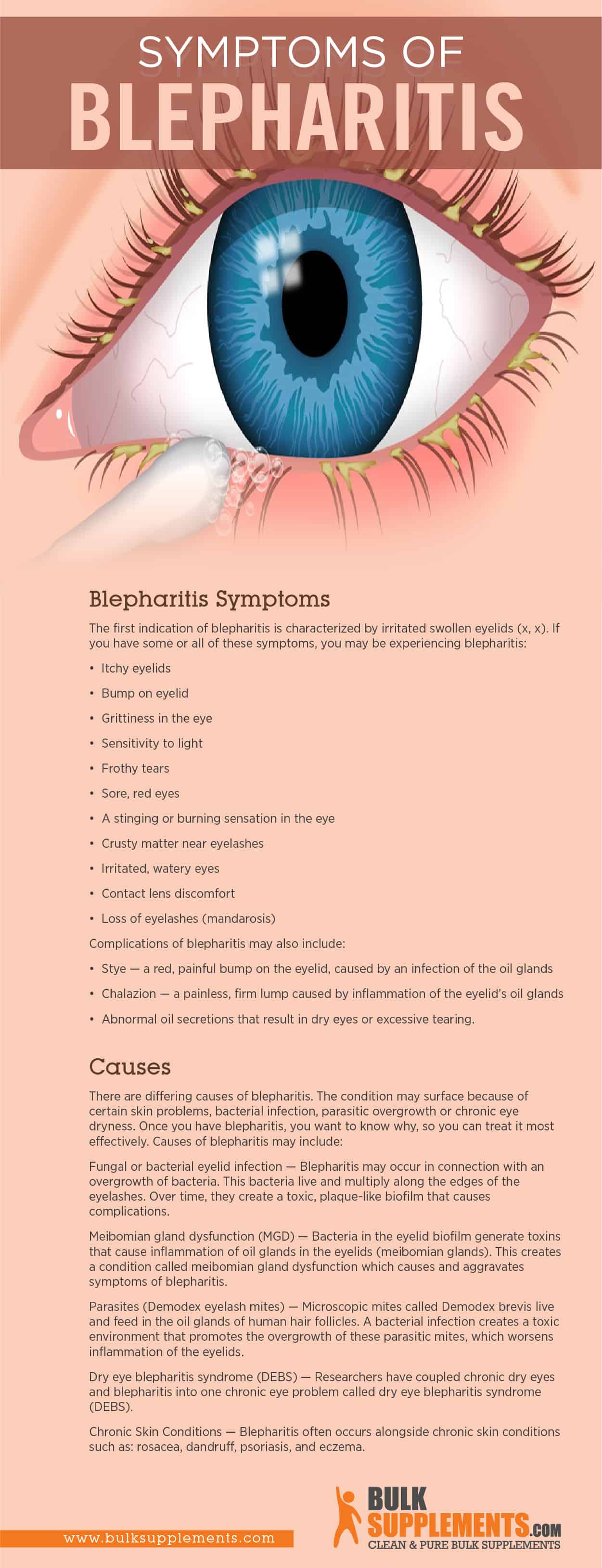 Blepharitis Infographic