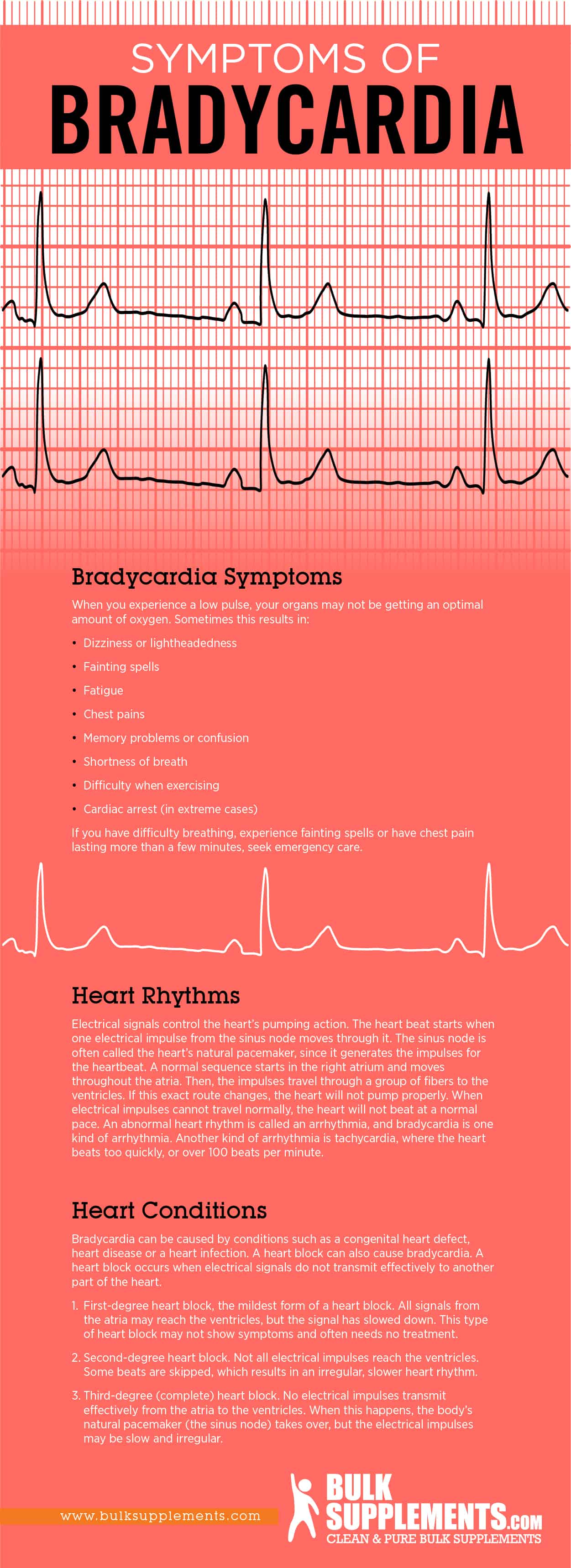 Bradycardia Symptoms