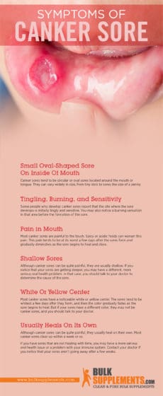 Canker Sores Symptoms Causes And Treatment By James Denlinger