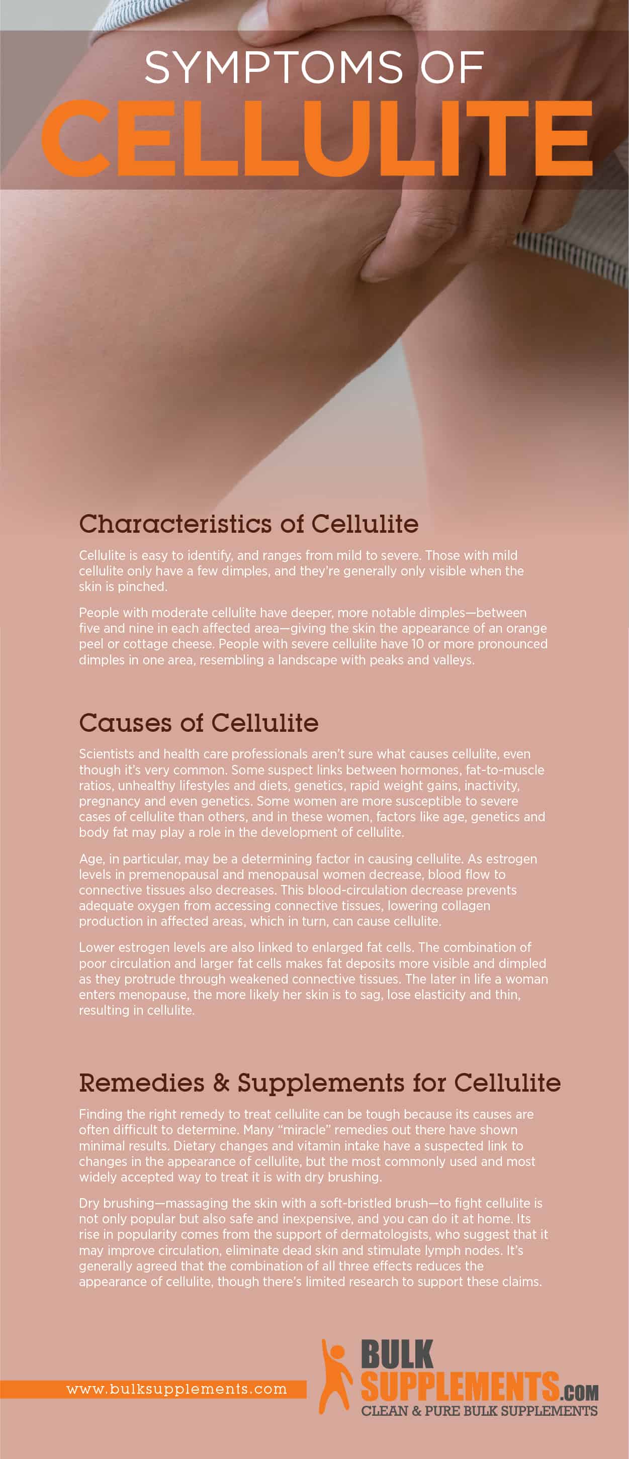 Cellulite, Causes & Treatment