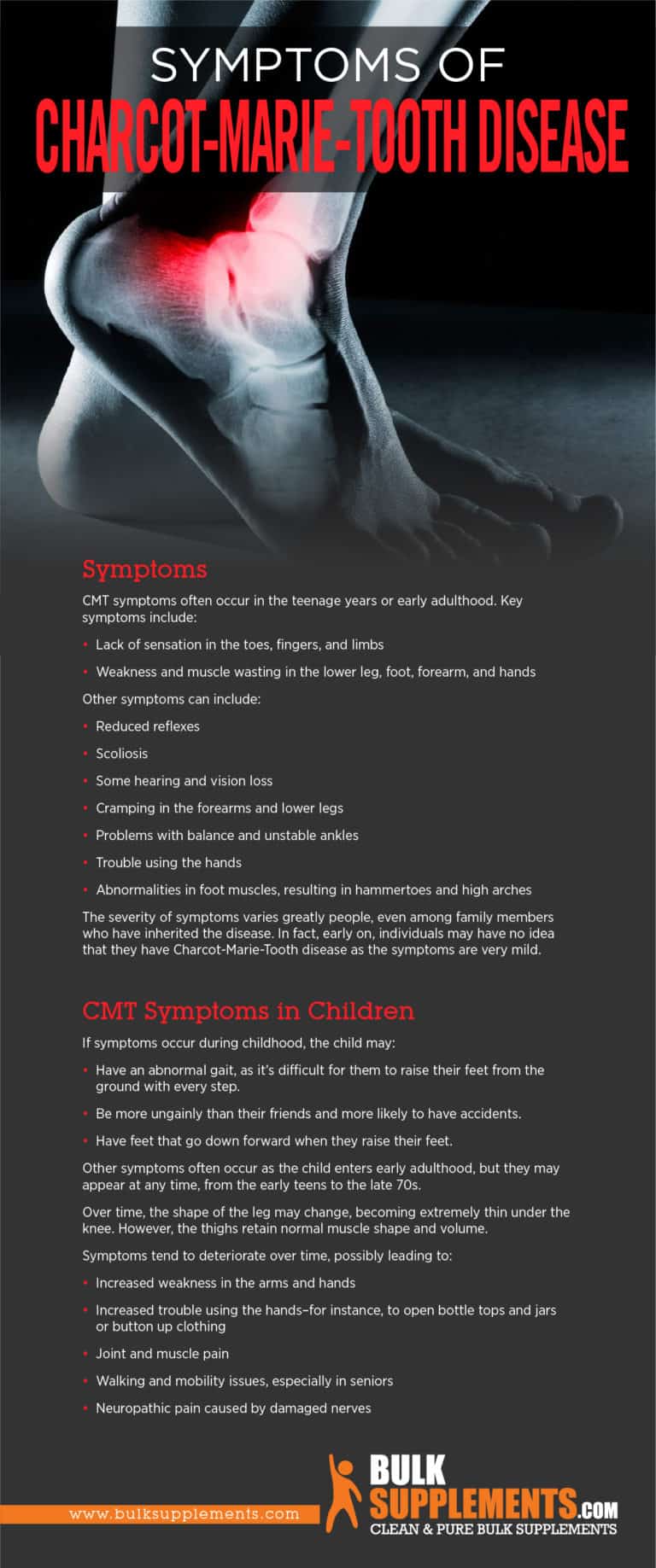 Charcot-Marie-Tooth Disease Symptoms and Treatment