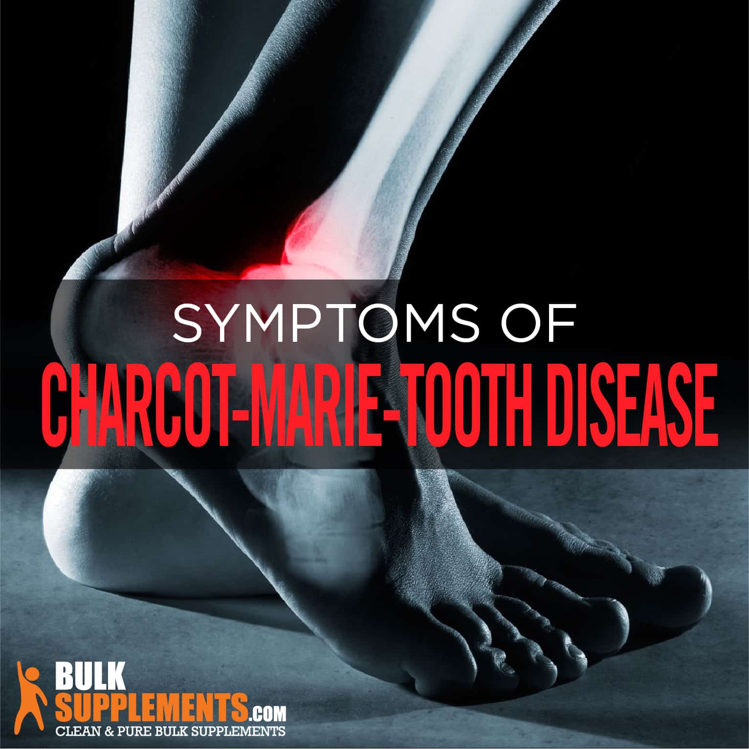 Charcot-Marie-Tooth Disease