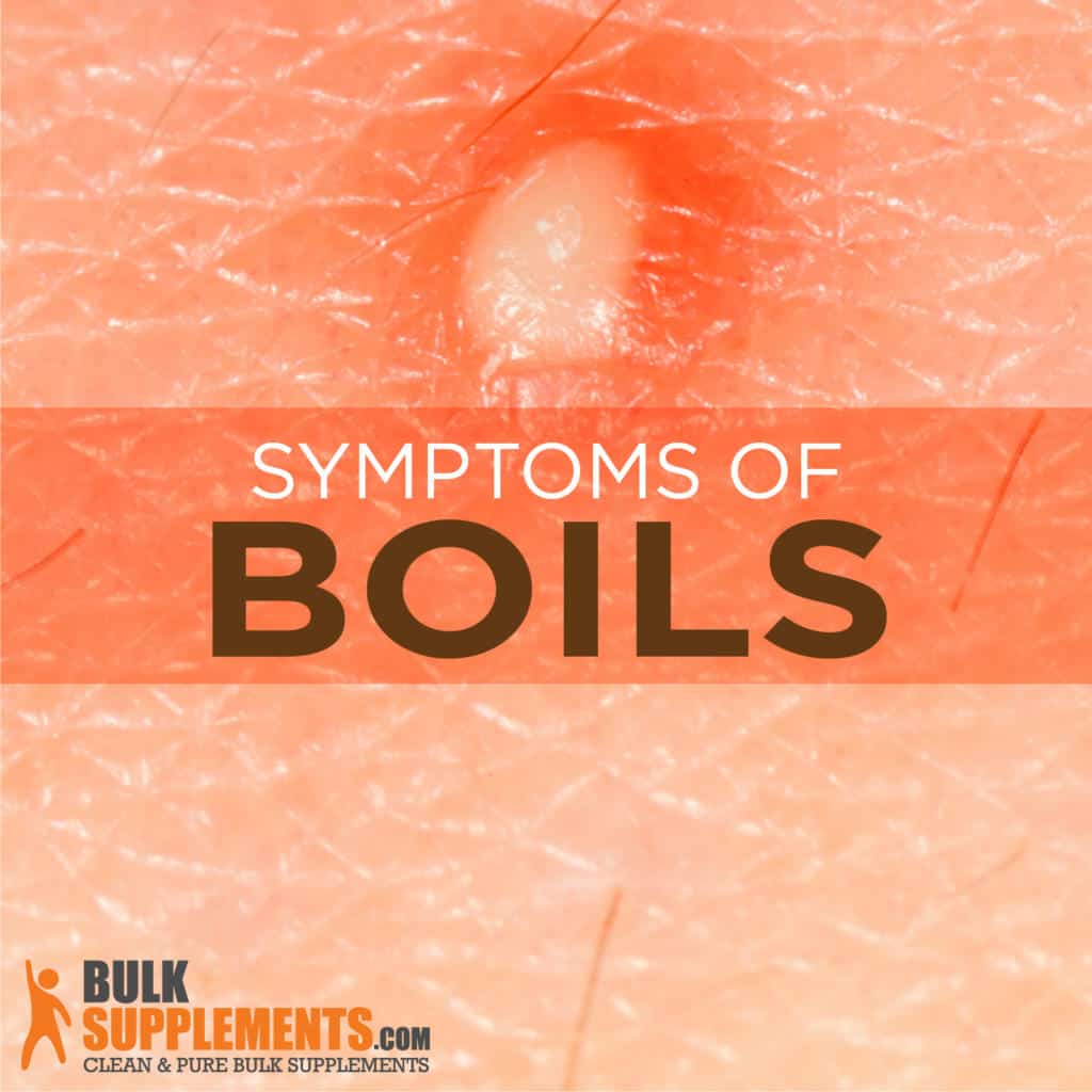 Boils Symptoms Causes And Treatment