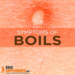 Boils: Symptoms, Causes and Treatment