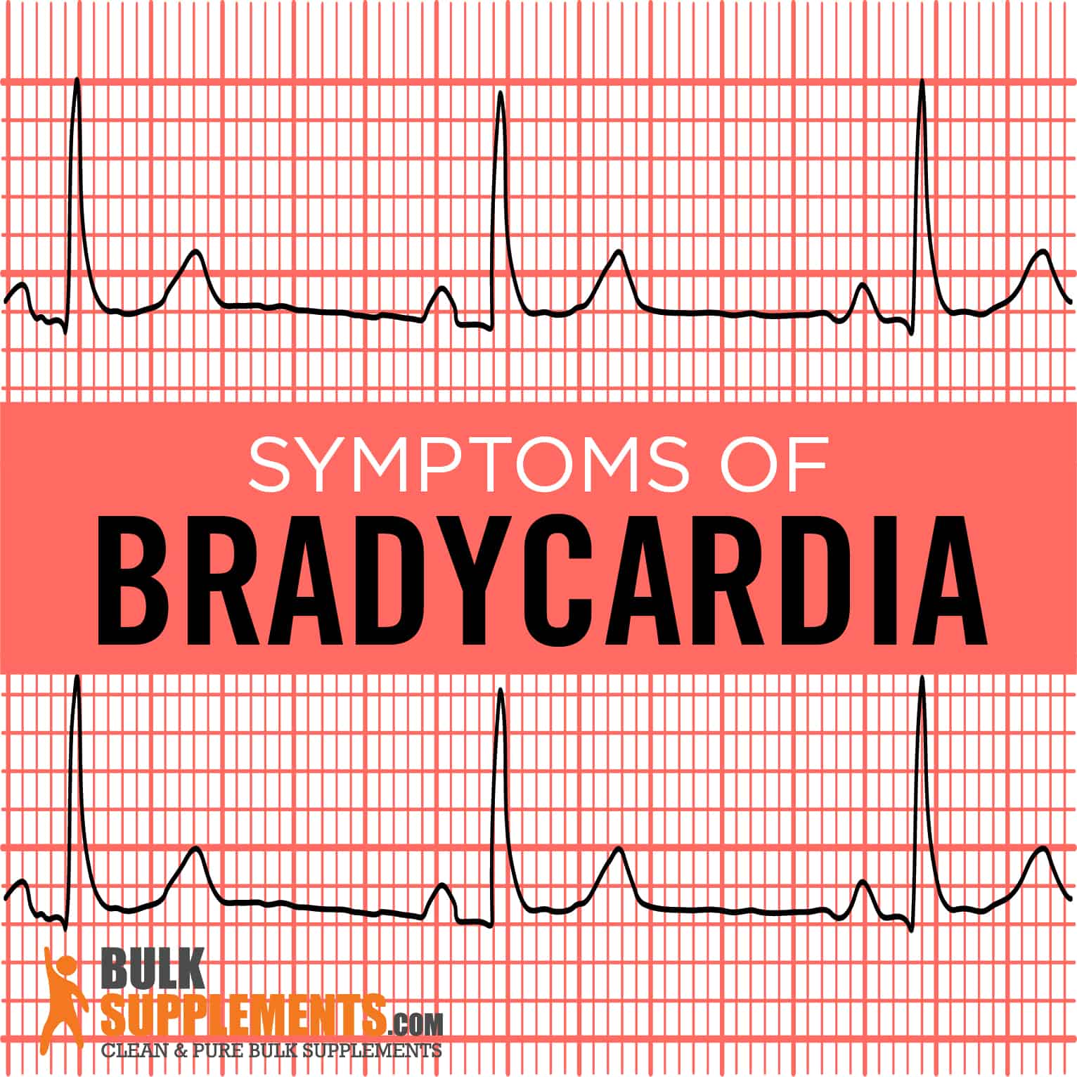 What Is The Leading Cause Of Bradycardia For Pediatric Patients