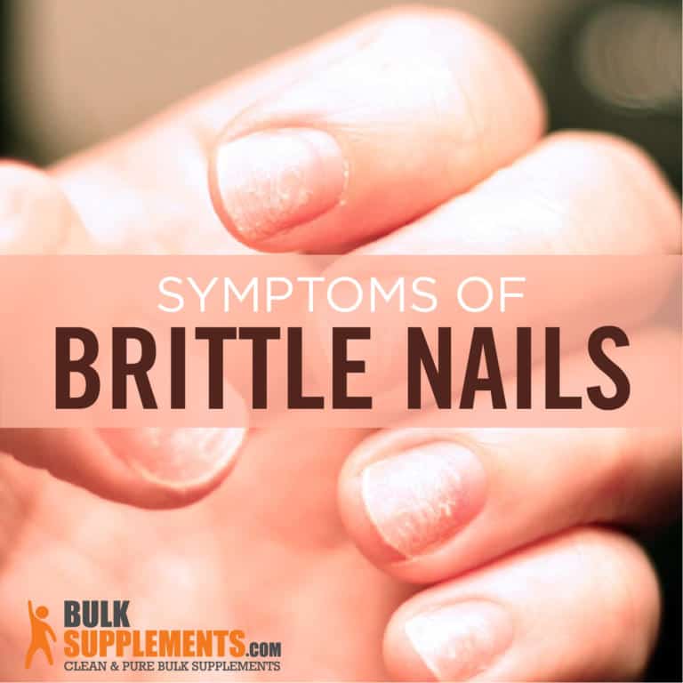 Brittle Nails Symptoms, Causes and Treatment