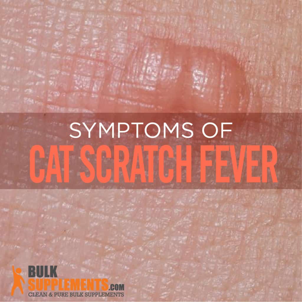 Cat Scratch Fever Characteristics Causes Treatment