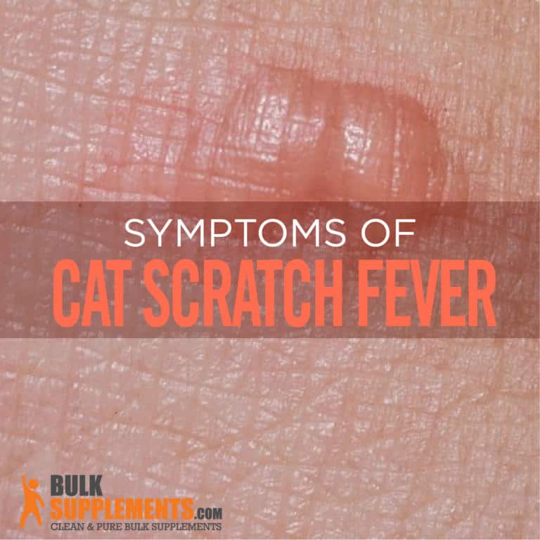 Cat Scratch Fever Characteristics Causes And Treatment
