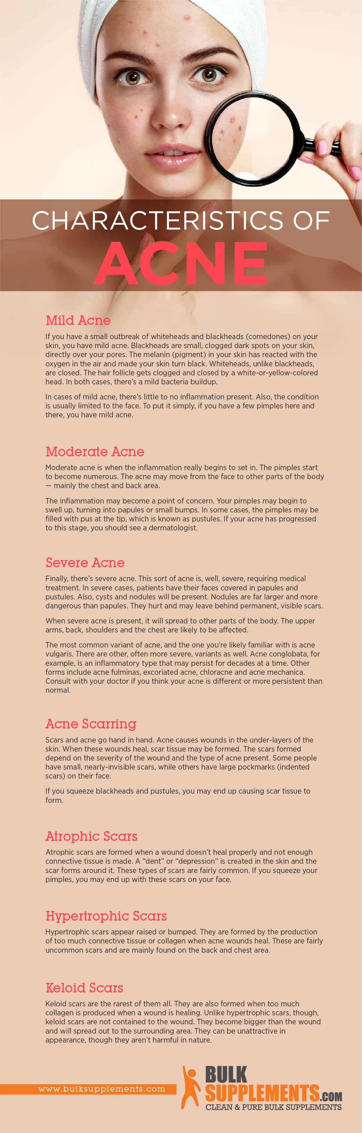 Acne Symptoms