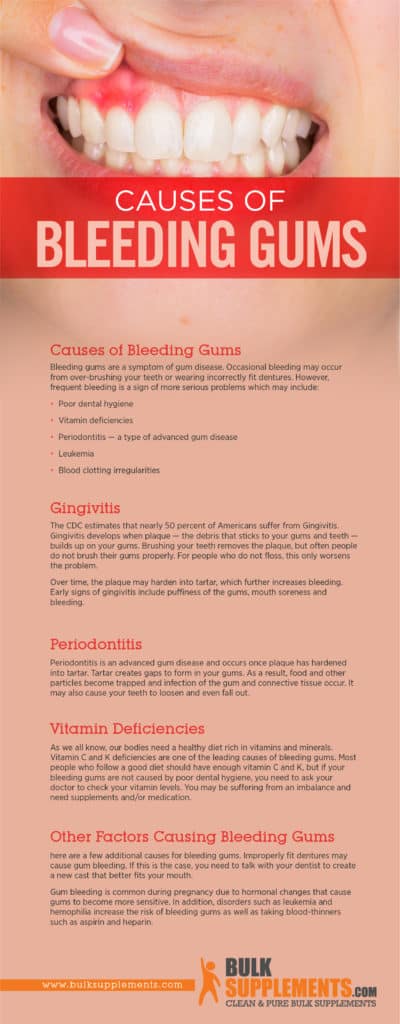 Bleeding Gums: Characteristics, Causes & Treatment