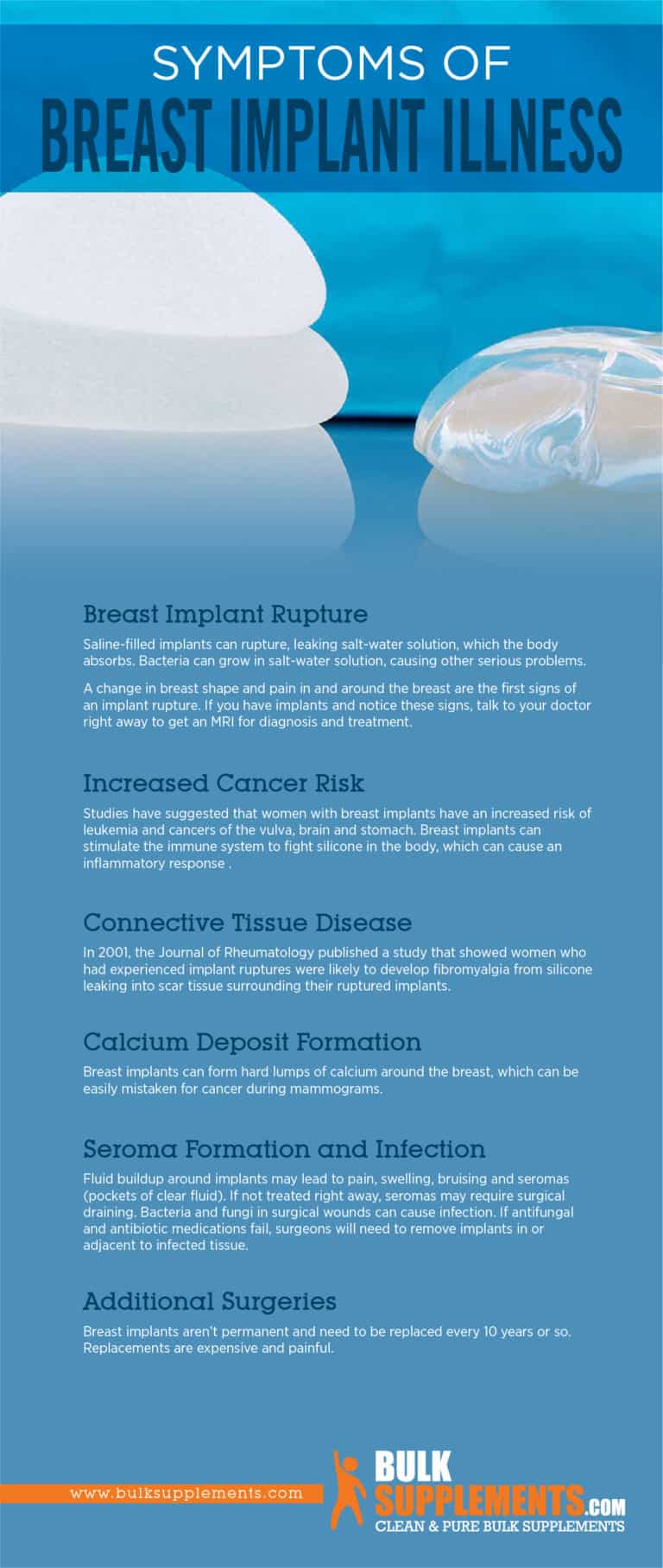 Breast Implant Illness: Symptoms, Causes & Treatment