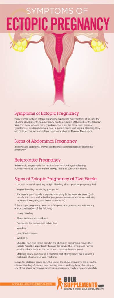 ectopic-pregnancy-characteristics-causes-treatment