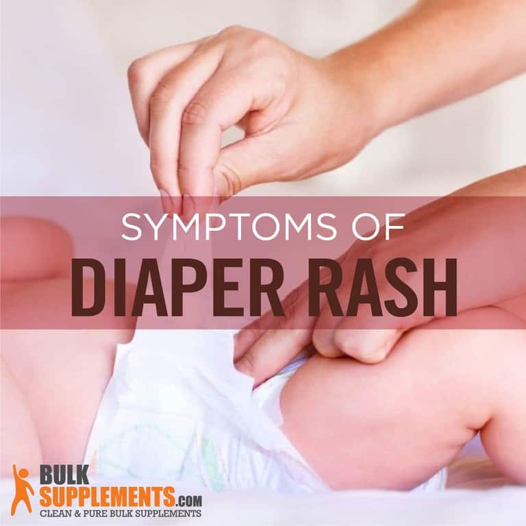 Diaper Rash: Characteristics, Causes & Treatment