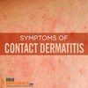 Contact Dermatitis: Symptoms, Causes & Treatment