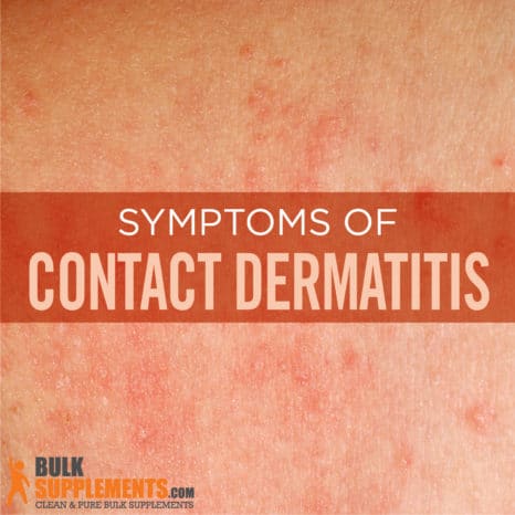 Contact Dermatitis: Symptoms, Causes & Treatment