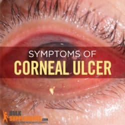 Corneal Ulcer: Characteristics, Causes & Treatment