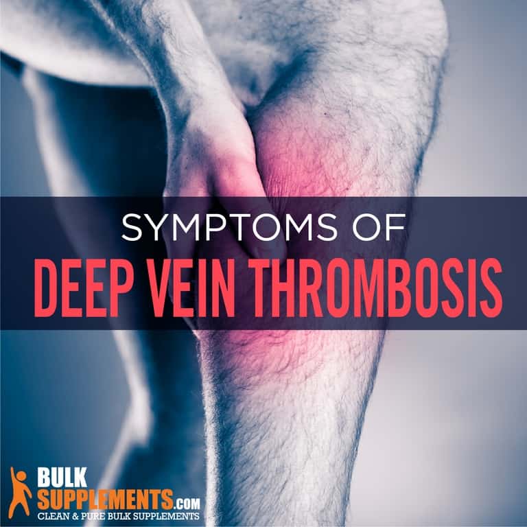 deep vein thrombosis bruise