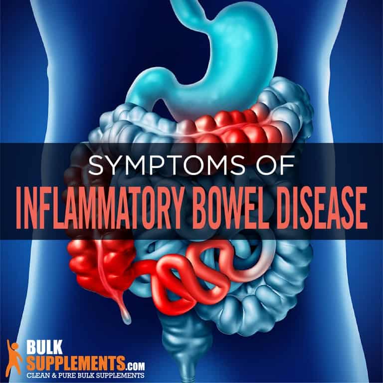 Inflammatory Bowel Disease (IBD) Symptoms, Causes & Treatment