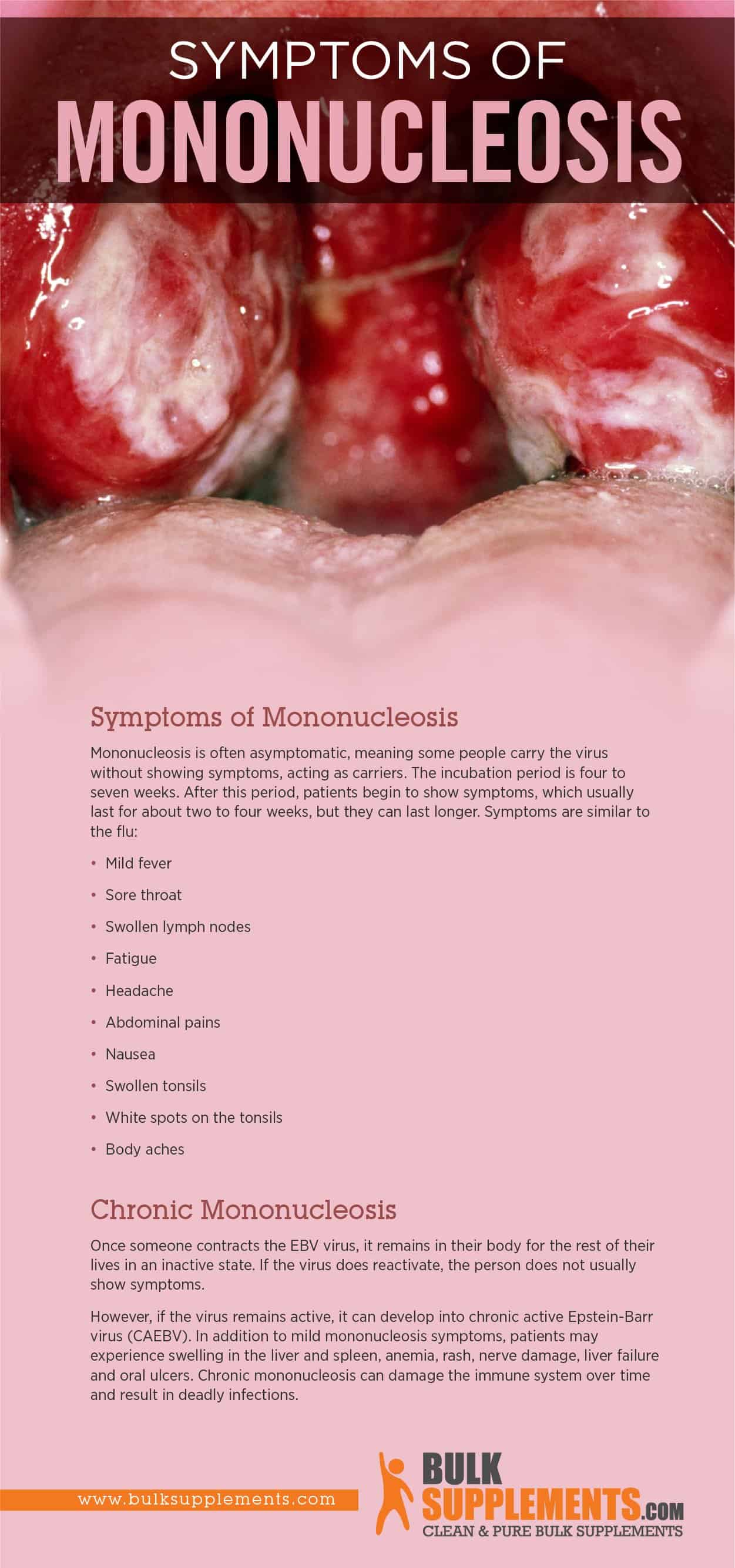 mono symptoms in adults