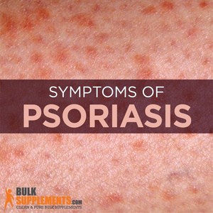 What is Psoriasis: Causes, Symptoms & Treatment