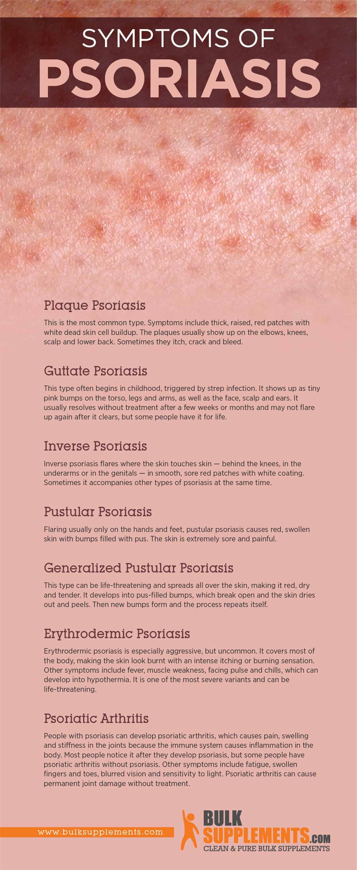 Psoriasis Symptoms