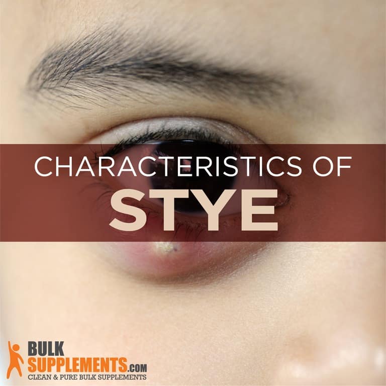 Stye Characteristics, Causes & Treatment