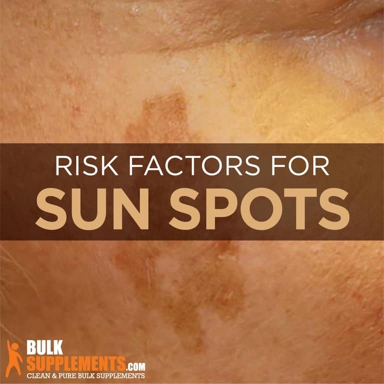 What Are Sunspots Symptoms Causes And Treatment