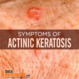 What is Actinic Keratosis: Symptoms, Causes, Treatment