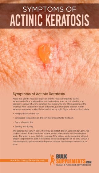 What Is Actinic Keratosis Symptoms Causes Treatment