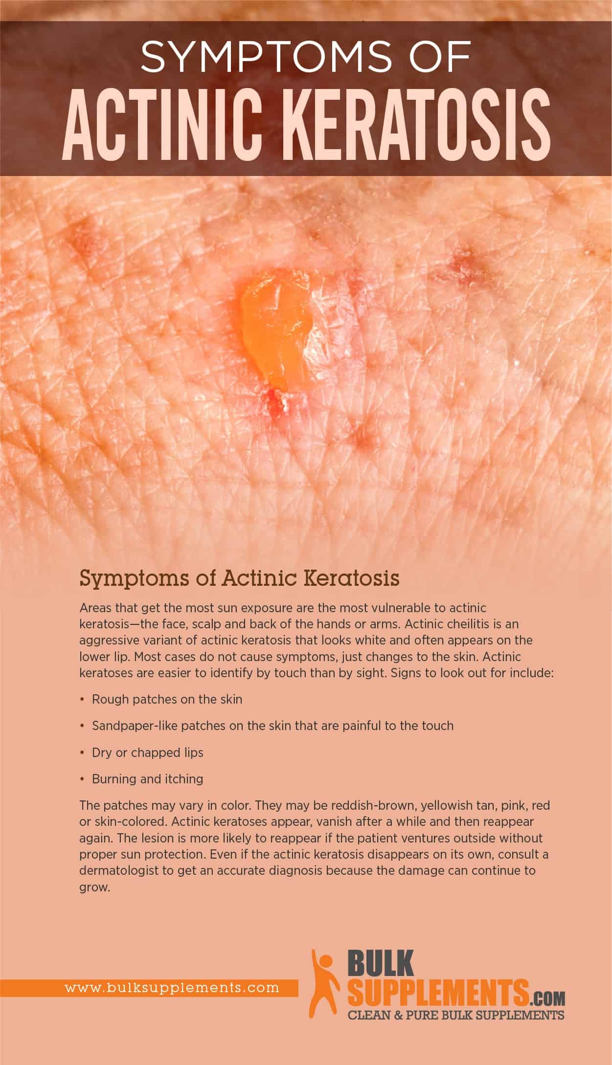 actinic keratosis arm