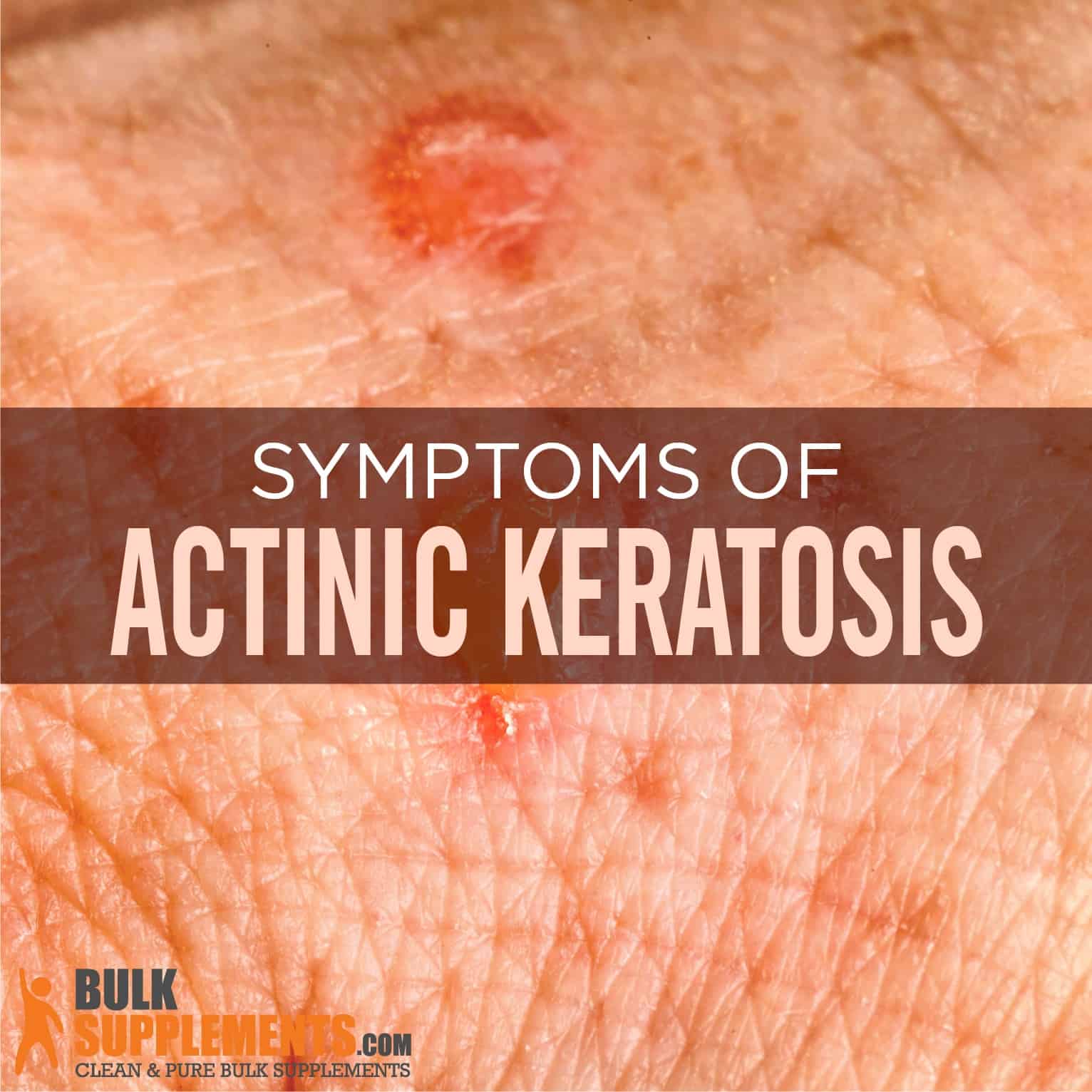 What Is Actinic Keratosis Symptoms Causes Treatment