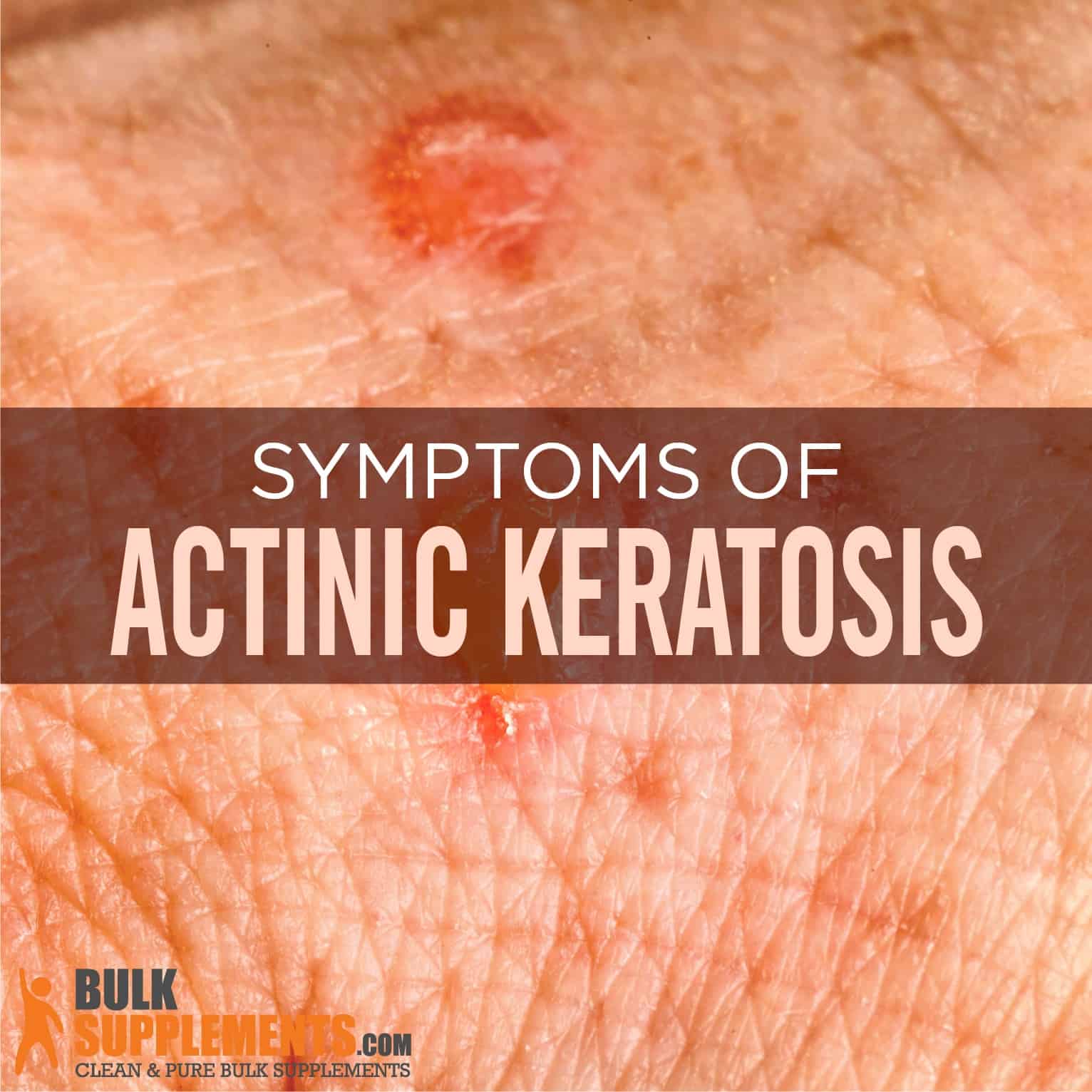 Actinic Keratosis Symptoms Causes Treatment And Cost