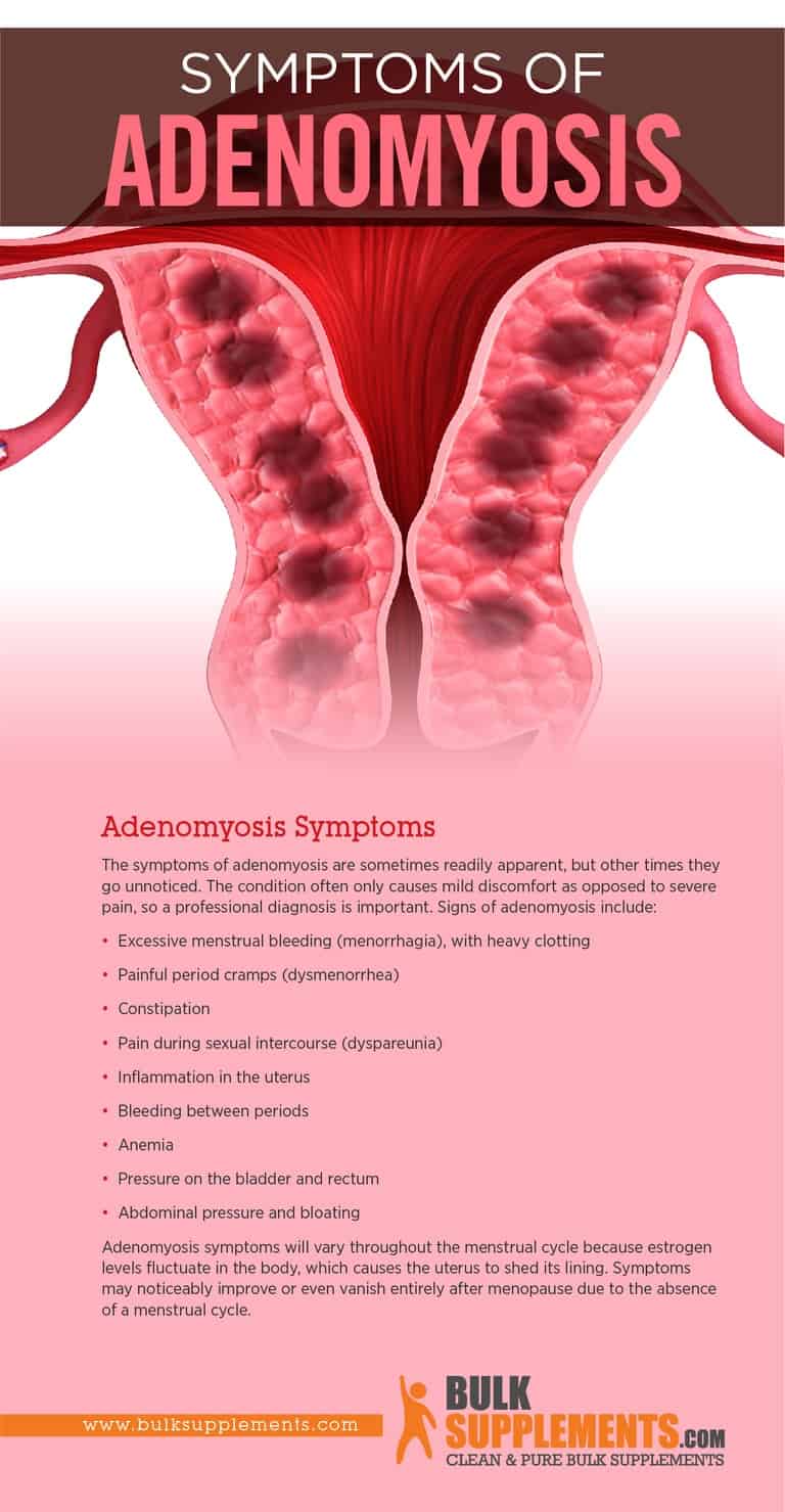 What is Adenomyosis Causes, Symptoms & Treatment