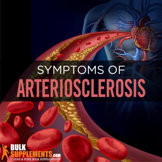 What is Arteriosclerosis: Symptoms, Causes & Treatment