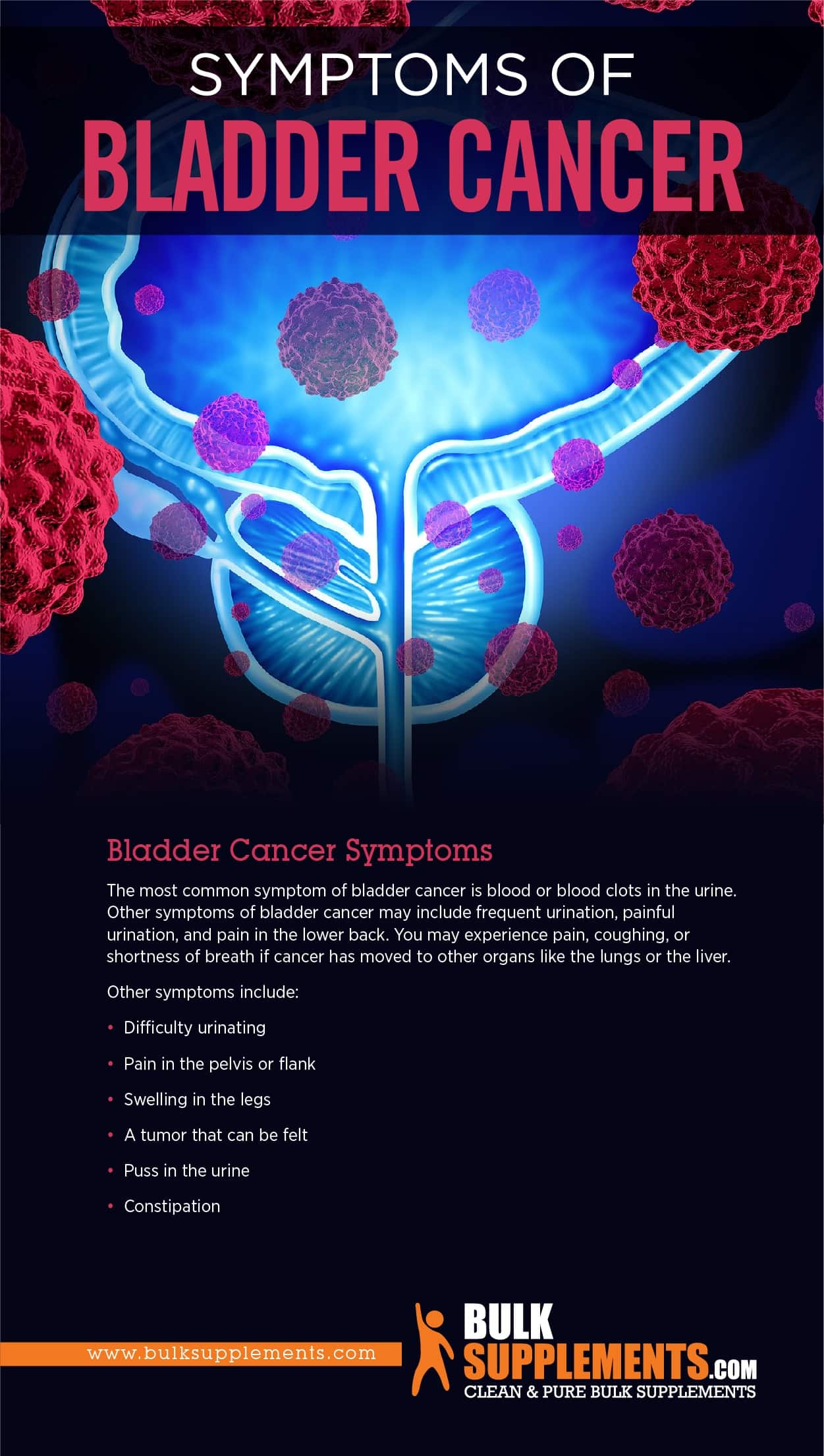 Bladder Cancer: Symptoms, Causes & Treatment ...