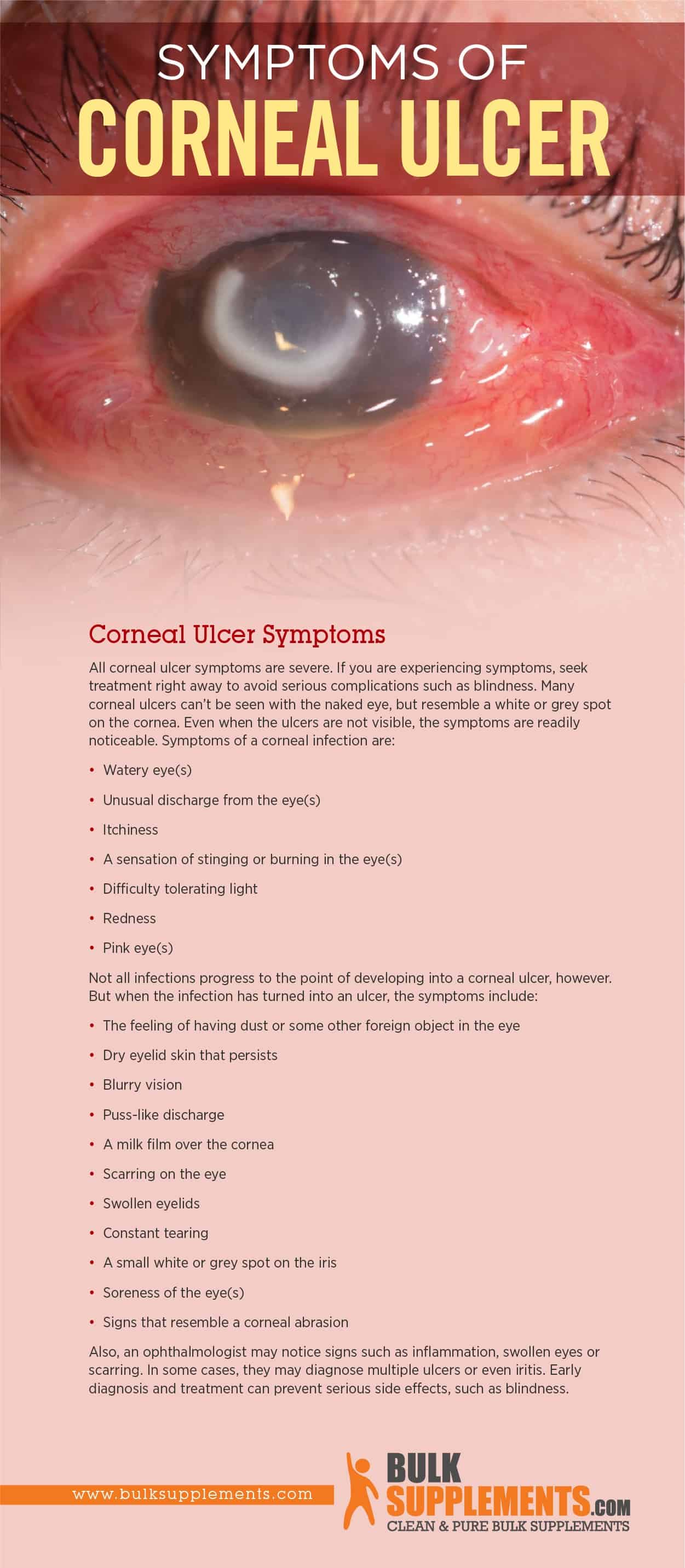 Corneal Ulcer Symptoms