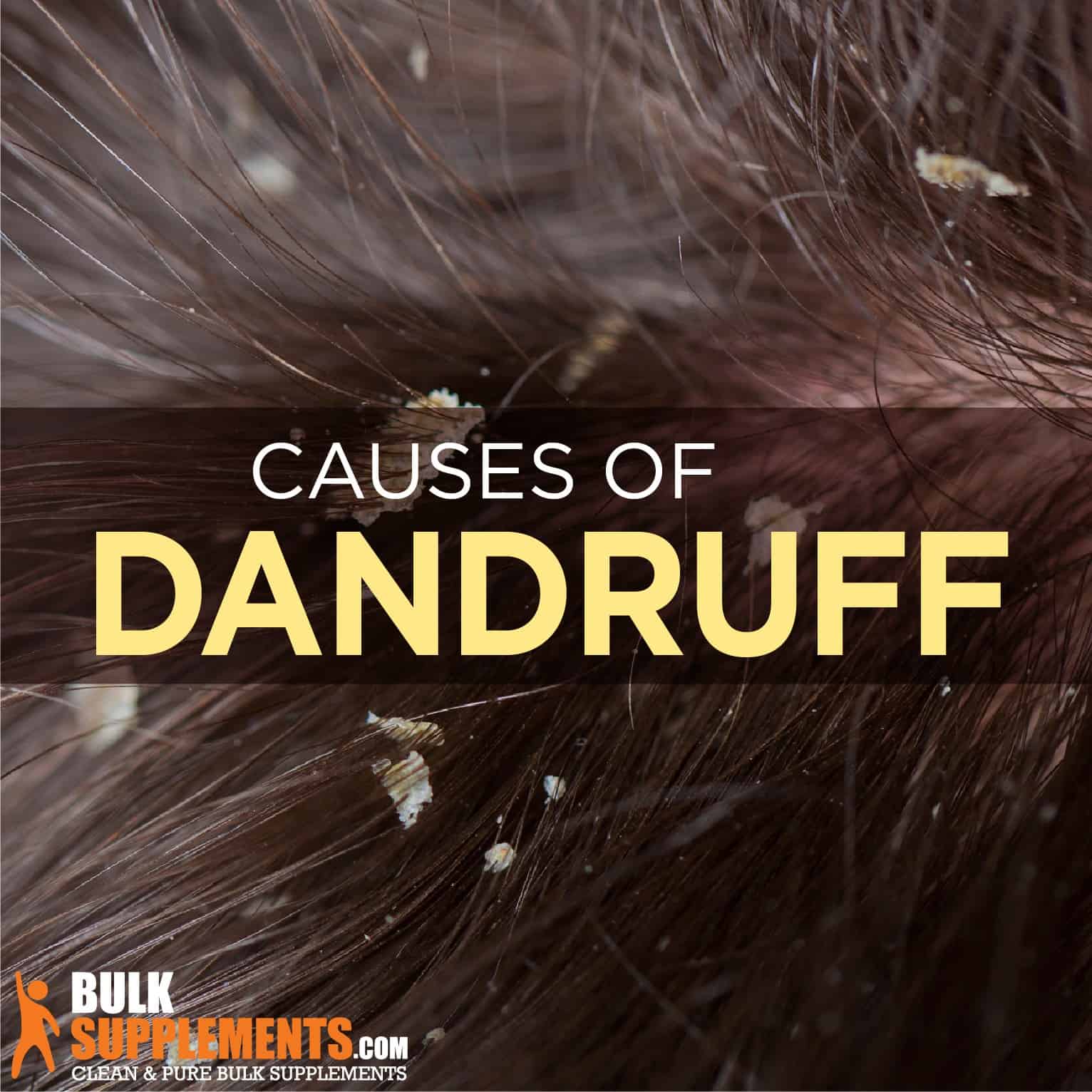 Dandruff