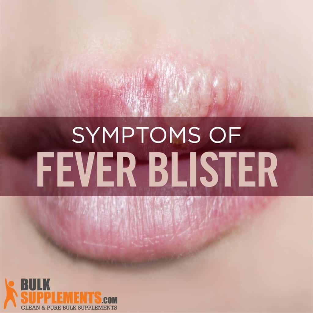 how-to-get-rid-of-fever-blisters-on-lips-lipstutorial